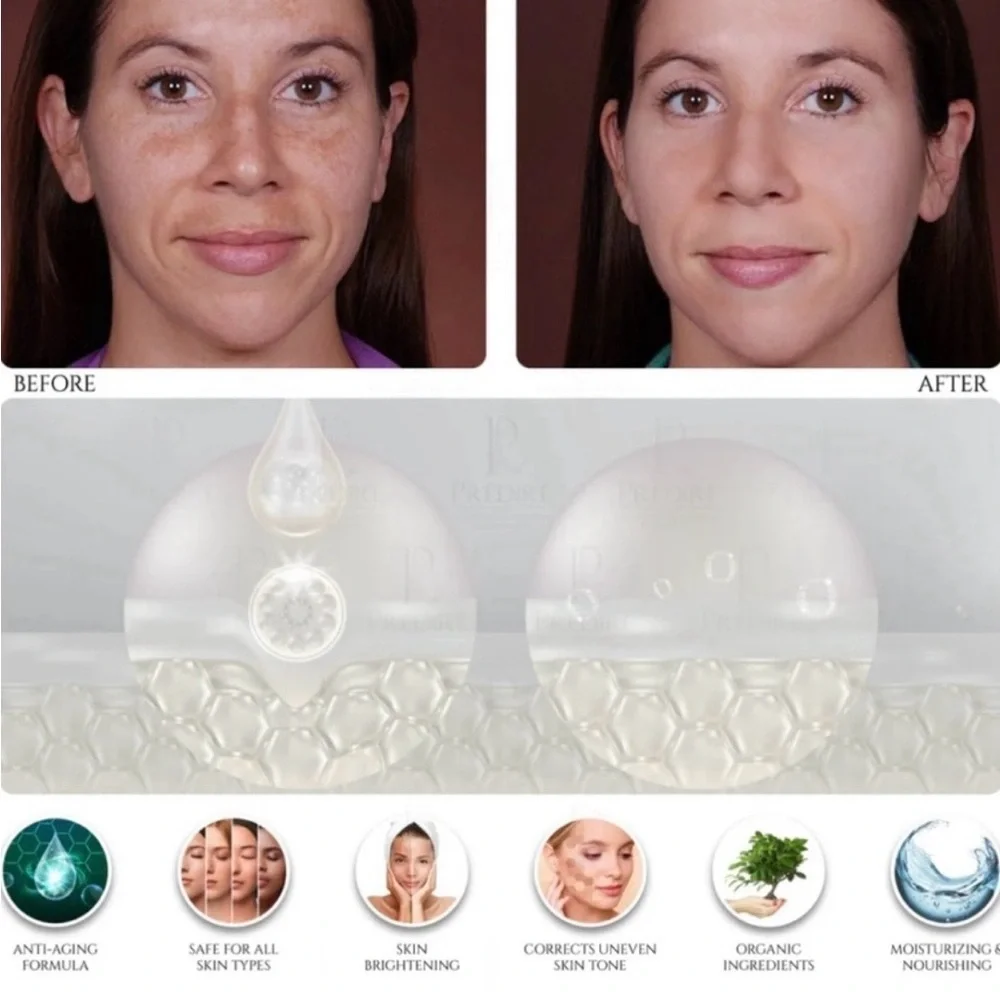 Prédiré Paris Skincare Non Surgical Solution NEW